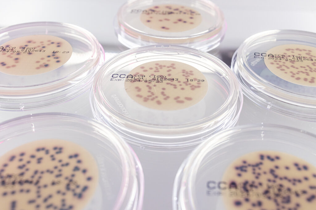 Mehrere Petrischalen mit transparenten Deckeln; auf Membranfiltern wachsen auf chromogenem Nährboden (CCA) violette und blau-dunkle Kolonien – Vorbereitung zur Koloniezählung in der Trinkwasseranalyse.